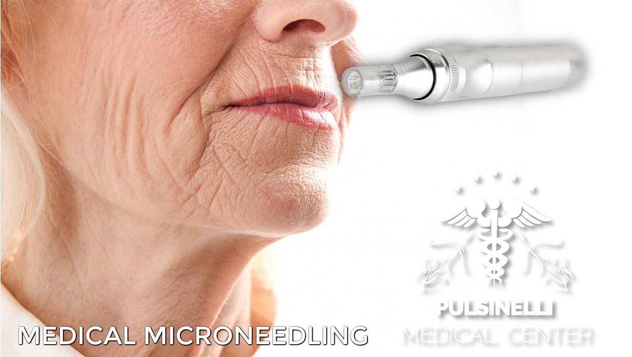 MEDICAL MICRONEEDLING