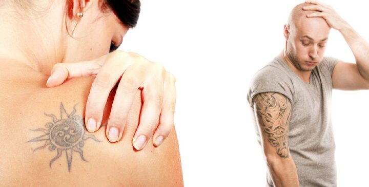 LASER RIMOZIONE TATUAGGI-01_2000x1011