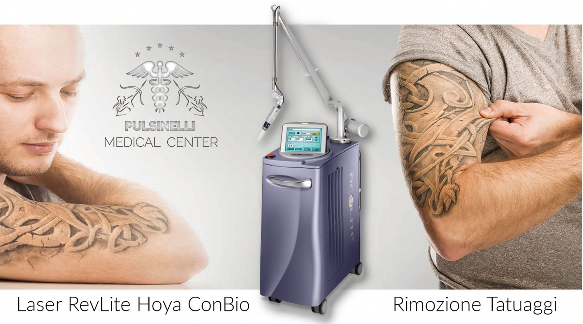 REVLITE-LASER-RIMOZIONE-TATUAGGI-PULSINELLI-MEDICAL-CENTER-1_2000x1113