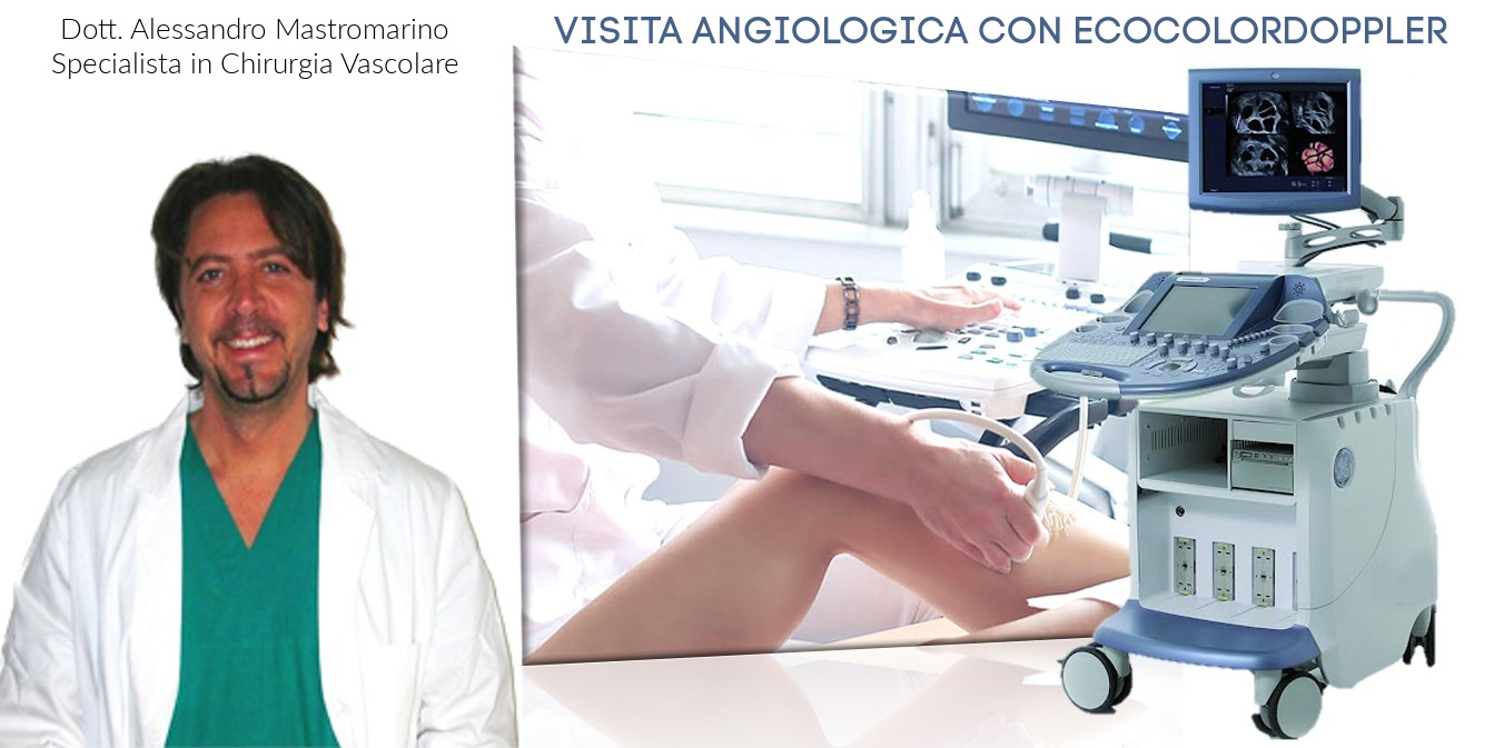 COME ELIMINARE I CAPILLARI E LE VENE VARICOSE DALLE GAMBE