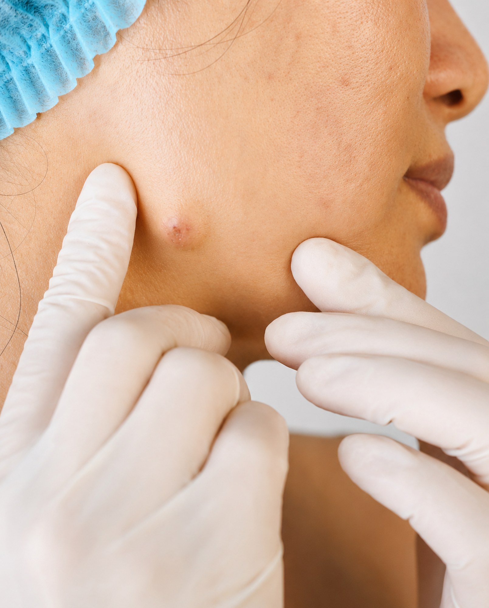 PULIZIA VISO MEDICALE 3_1609x2000